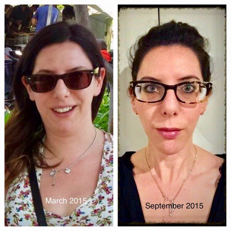 Simone Cohn - Fibromyalgia Health Journey - Prolongevity Simone Cohn - Fibromyalgia Health Journey - Prolongevity