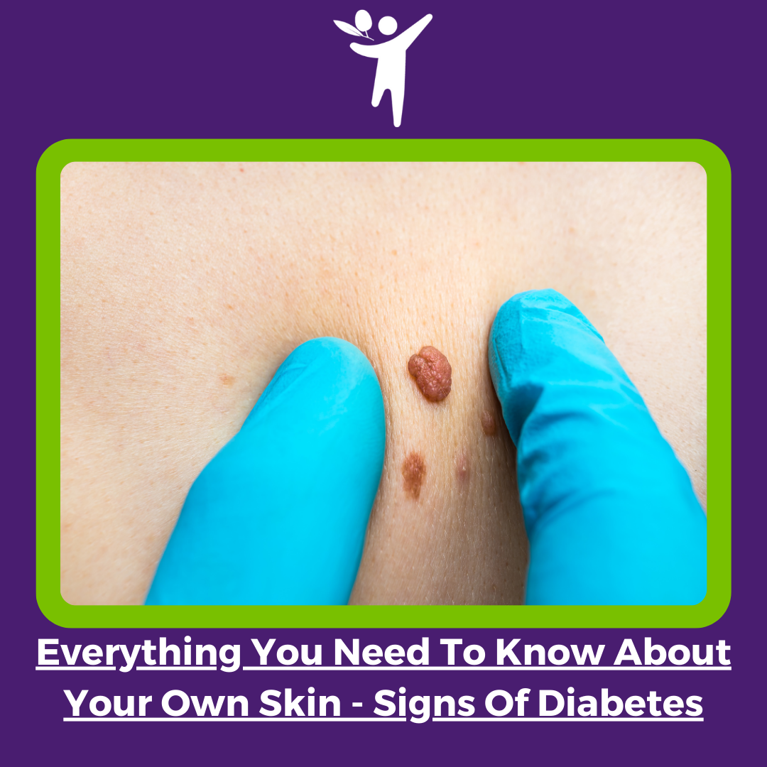 Everything You Need To Know About Your Own Skin – Signs Of Diabetes